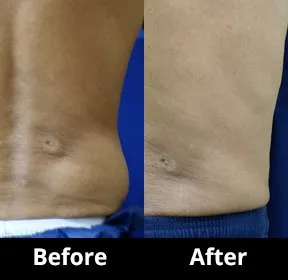 Face and Body Sculpting 10