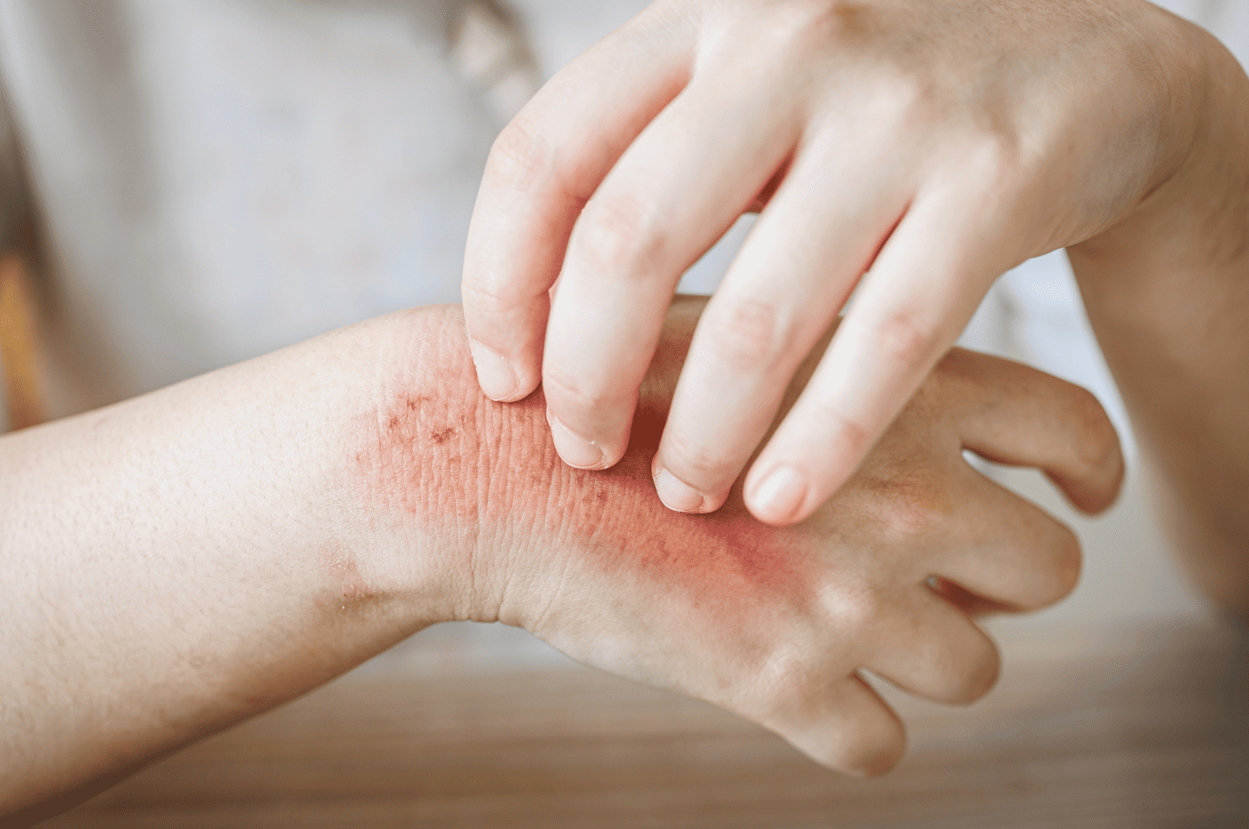 The Do’s and Don’ts of Caring for Vein-Related Wounds