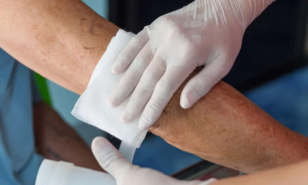 Simple Daily Habits That Support Venous Wound Recovery